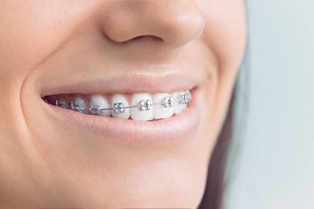 Dental X-Rays and Imaging in Pleasant Hill, CA